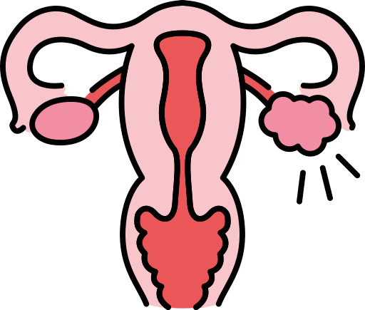 PCOS Management